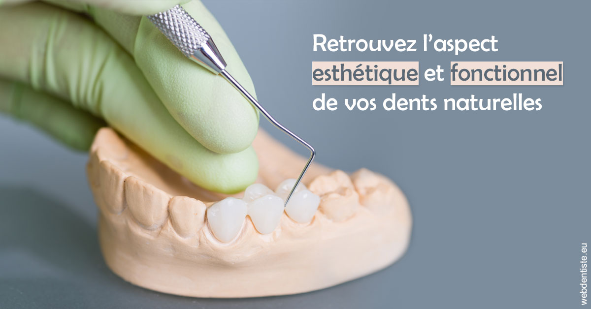 https://dr-meyer-jm.chirurgiens-dentistes.fr/Restaurations dentaires 1