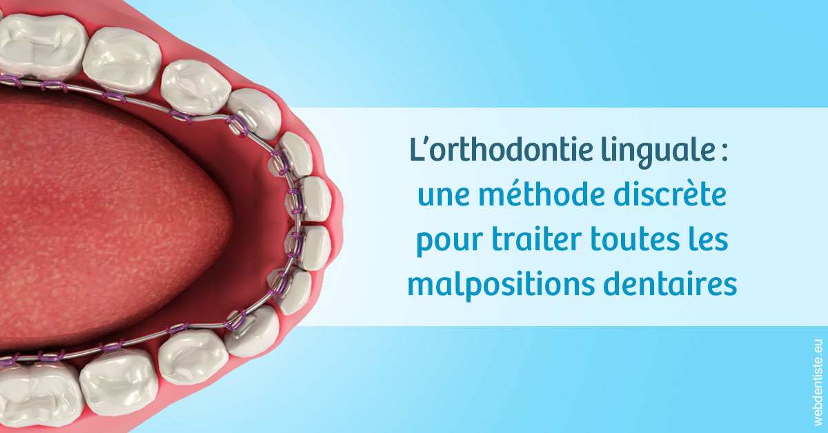 https://dr-meyer-jm.chirurgiens-dentistes.fr/L'orthodontie linguale 1