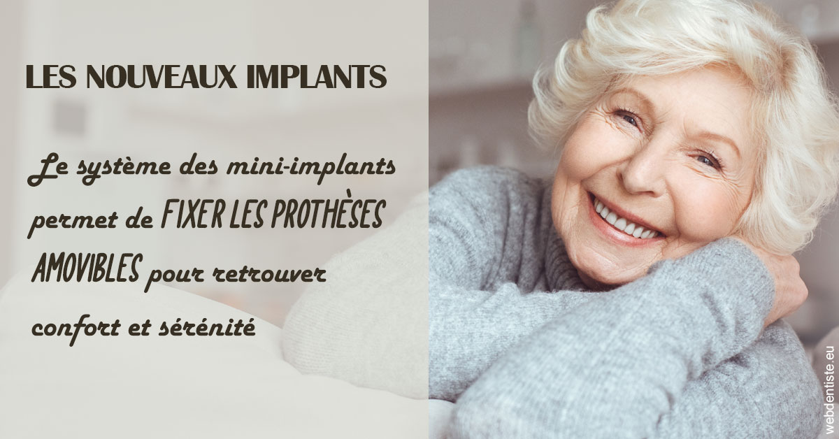 https://dr-meyer-jm.chirurgiens-dentistes.fr/Les nouveaux implants 1