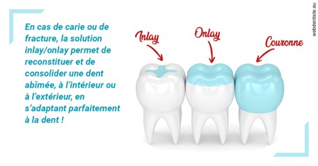https://dr-meyer-jm.chirurgiens-dentistes.fr/L'INLAY ou l'ONLAY