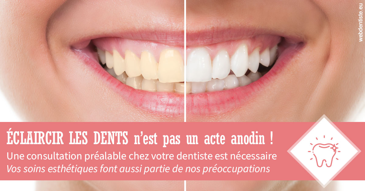 https://dr-meyer-jm.chirurgiens-dentistes.fr/Eclaircir les dents 1