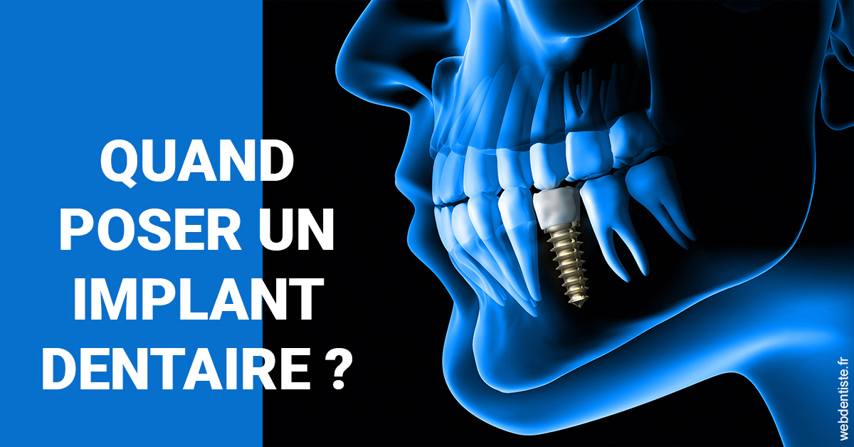 https://dr-meyer-jm.chirurgiens-dentistes.fr/Les implants 1