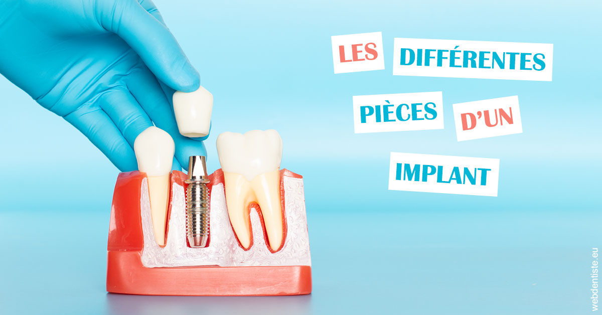 https://dr-meyer-jm.chirurgiens-dentistes.fr/Les différentes pièces d’un implant 2