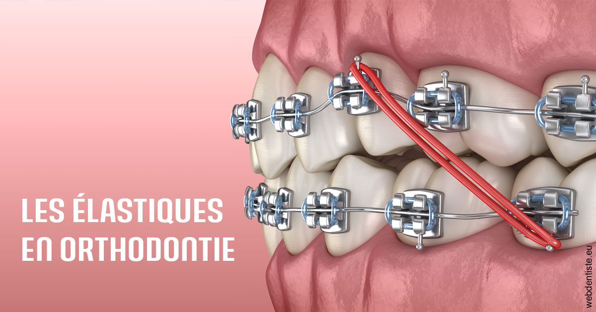 https://dr-meyer-jm.chirurgiens-dentistes.fr/Elastiques orthodontie 2
