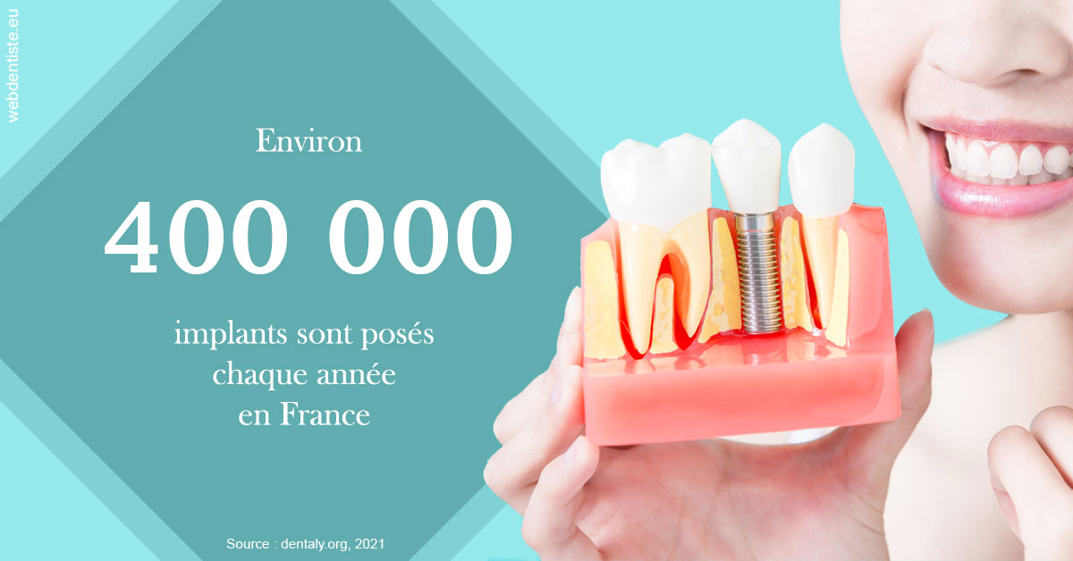https://dr-meyer-jm.chirurgiens-dentistes.fr/Pose d'implants en France 2